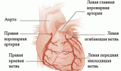Причины и лечение ишемической болезни сердца