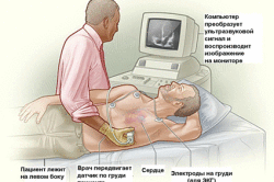 Эхокардиография как метод диагностики аортального стеноза